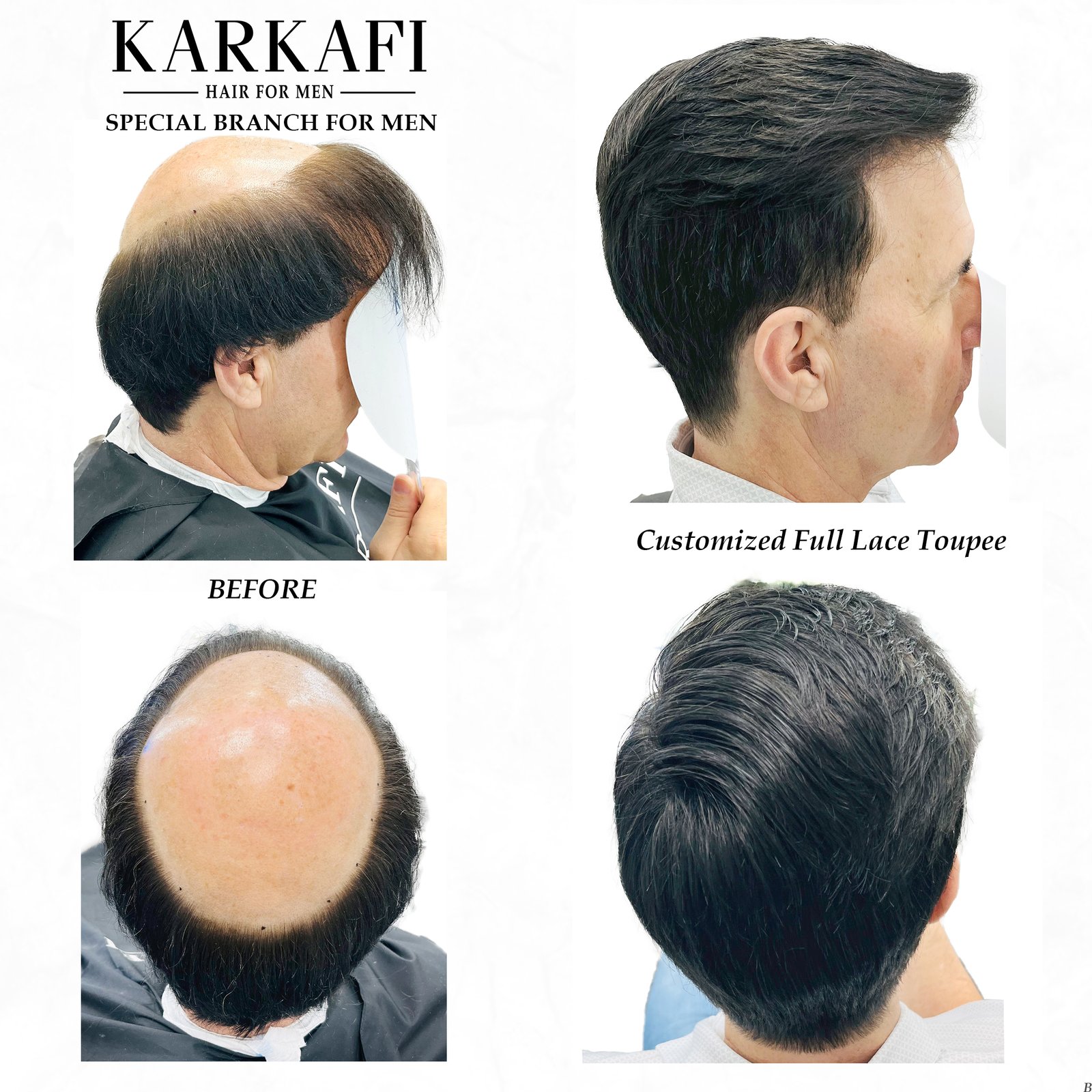 Hair Extensions & Wigs in Dubai – Karkafi Hair 7 Crown Area