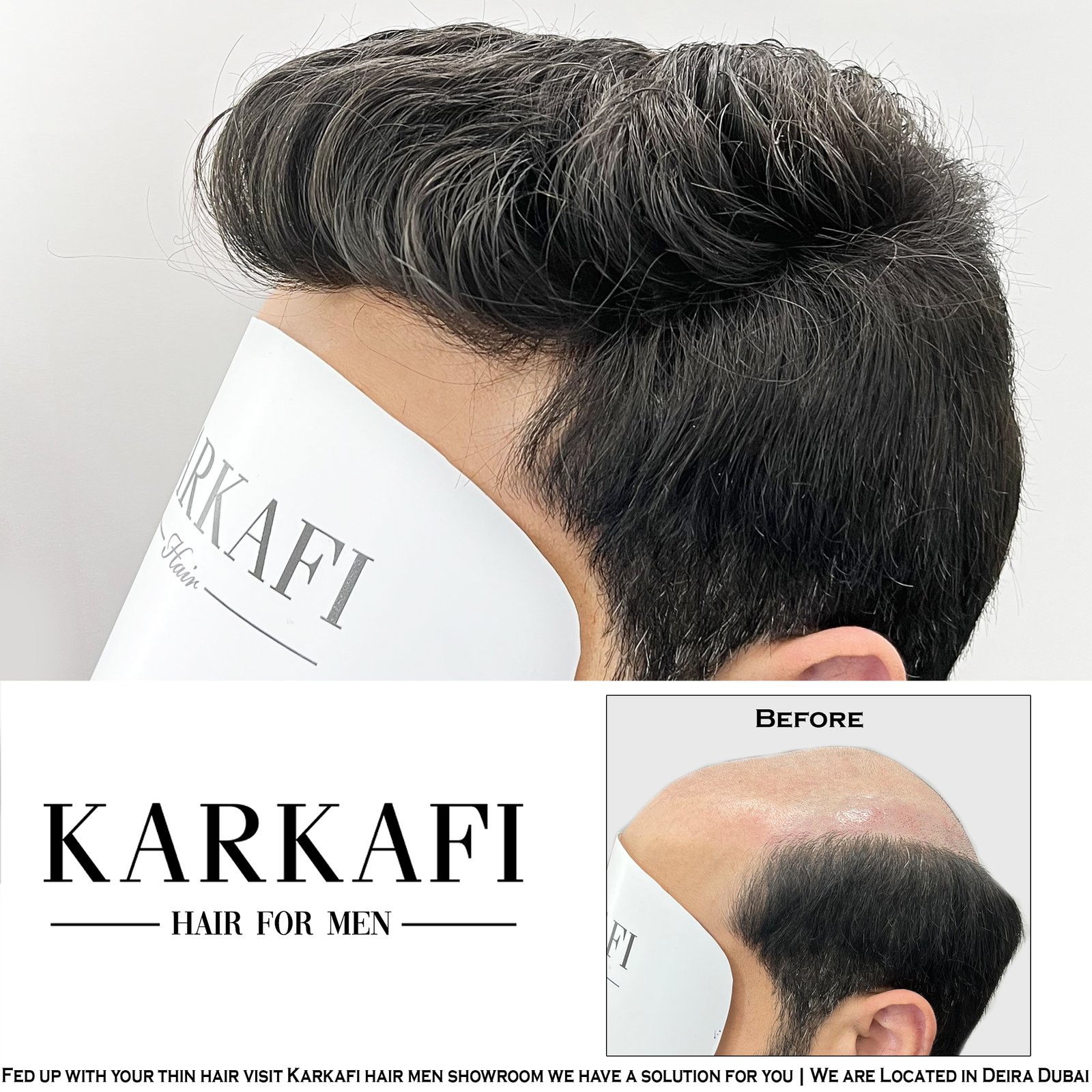 Hair Extensions & Wigs in Dubai – Karkafi Hair 4 Toupee