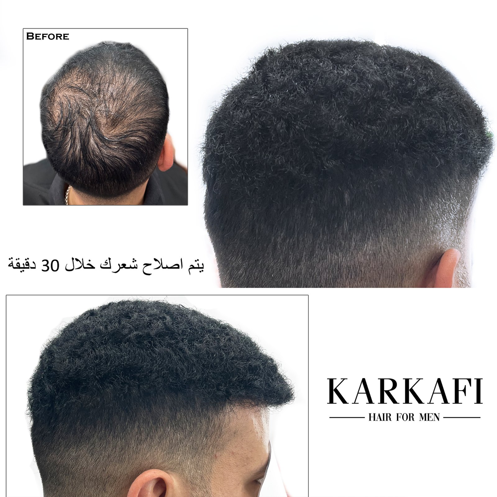 Hair Extensions & Wigs in Dubai – Karkafi Hair